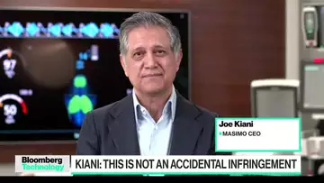 Masimo CEO Addresses Smartwatch Patent Dispute With Apple
