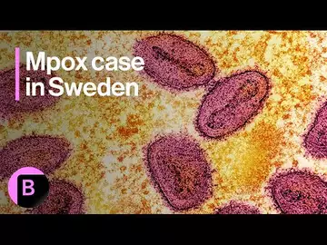 Mpox Latest: Case of New Variant Recorded in Sweden
